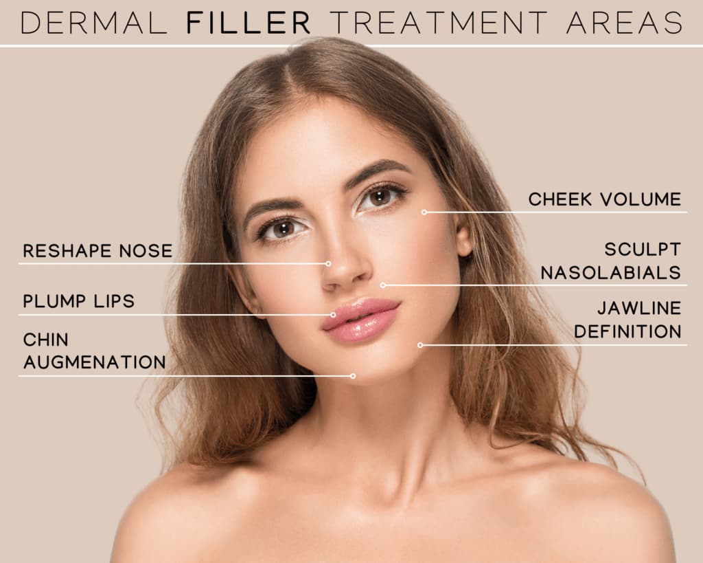 서브스킨 히알루론산 필러 서브스킨 히알루론산 필러